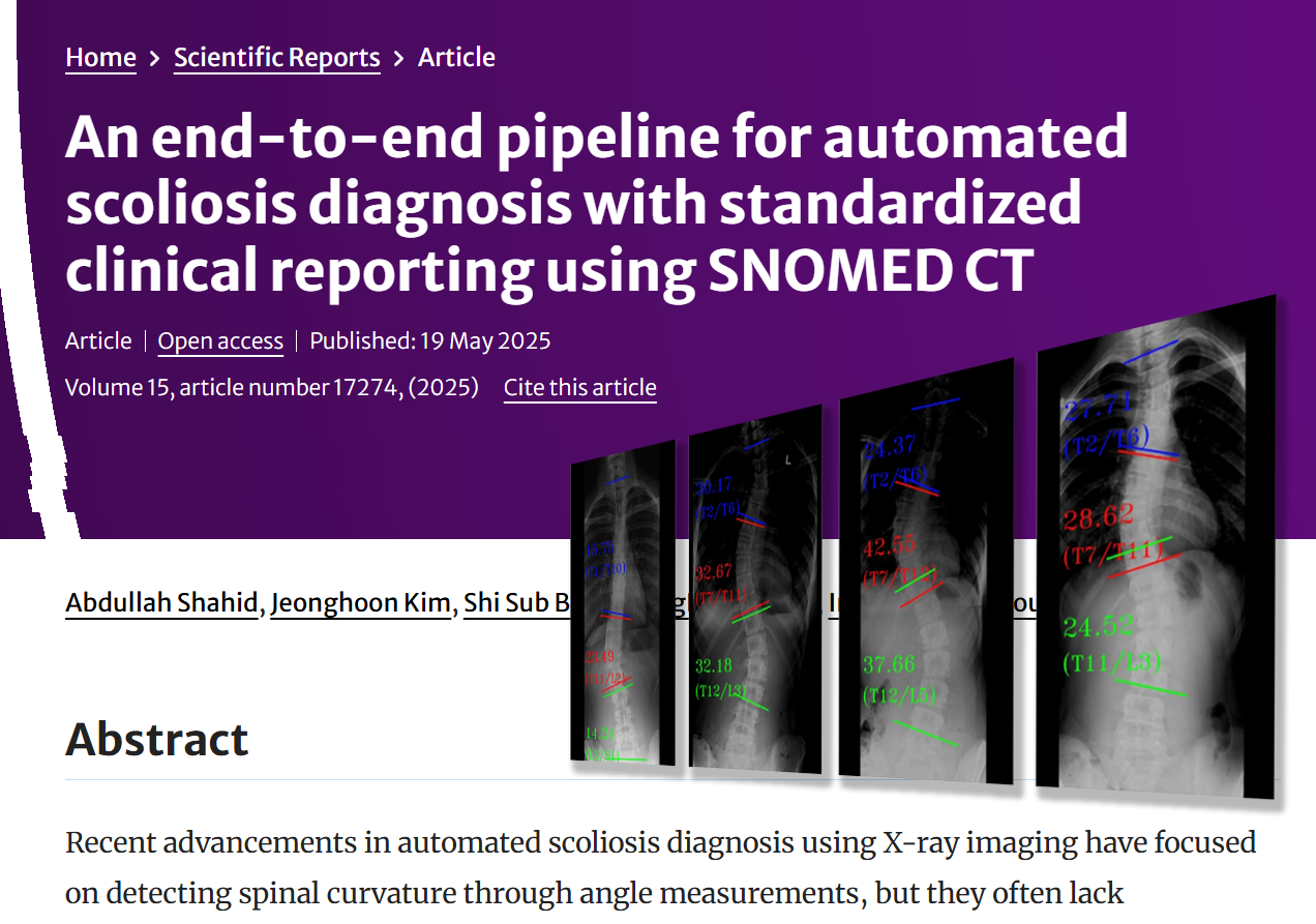 HealthHub’s AI Research on Automated Scoliosis Diagnosis Published in Scientific Reports